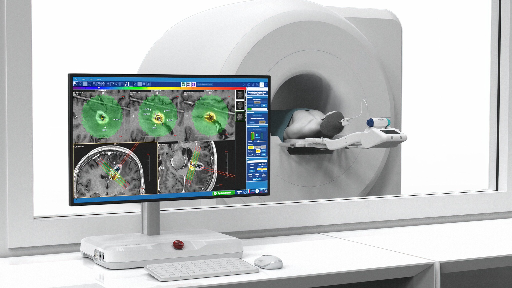 Picture of a monitor and a person in an MRI machine.