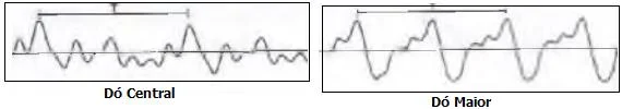 Prova Oscilação e Ondas para o Enem + IMAGEM 3