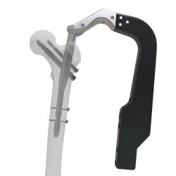 Haste Intramedular Proximal Femoral HPF2