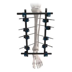 Fixador Externo Traufix Advanced