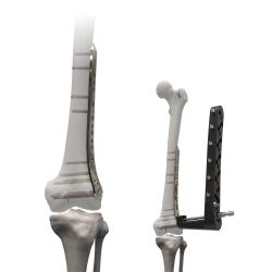 Placa Femoral Locking