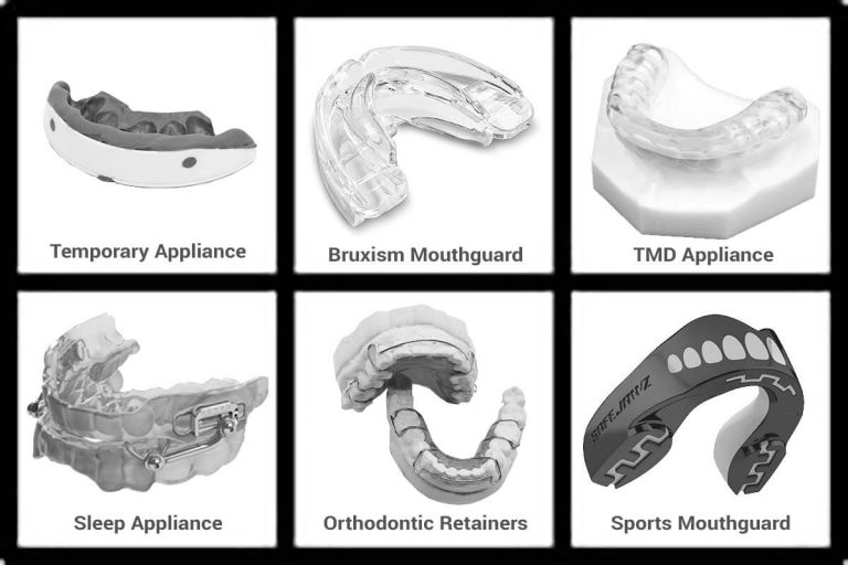 Custom Mouthguards for Teeth Grinding: Are They Worth It?