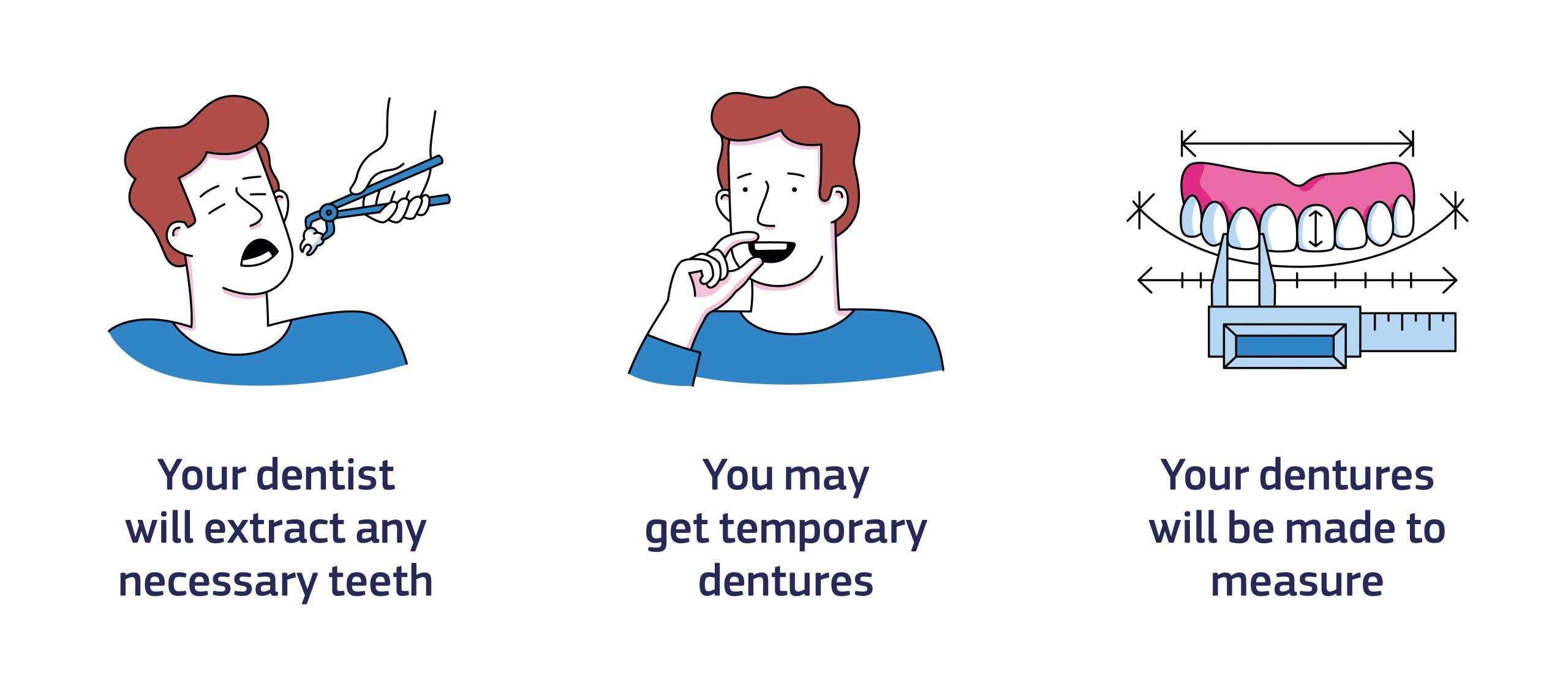 The Process of Getting Dentures: What You Need to Know