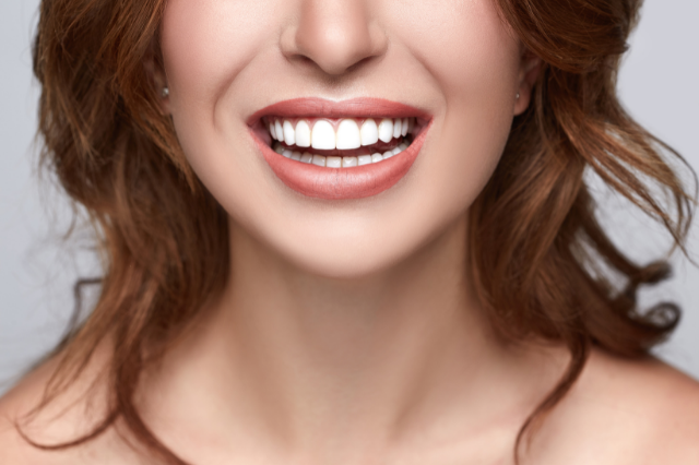 Close up of a woman smiling with bright white teeth